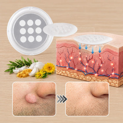 ✨ PURESHADE® 2v1 mikrojehličková + hydrokoloidní náplast🍀 | Pomáhá odstraňovat vystouplá znaménka, akné, ploché bradavice a kožní výrůstky | Pomáhá zjemnit vrásky, jizvy a nedokonalosti pleti | Diskrétní neviditelná náplast pro obličej i tělo