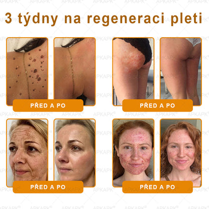 🔥  Dermatologicky a klinicky testováno🐝APKAPK®Bee Venom Krém na obnovení pleti🐝 pomáhá při léčbě kožních problémů, jako jsou: vrásky, jizvy, pigmentové skvrny, strie, akné, psoriáza, ekzém, kožní změny, podráždění, záněty a další kožní problémy.