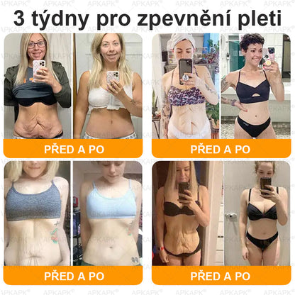 🔥  Dermatologicky a klinicky testováno🐝APKAPK®Bee Venom Krém na obnovení pleti🐝 pomáhá při léčbě kožních problémů, jako jsou: vrásky, jizvy, pigmentové skvrny, strie, akné, psoriáza, ekzém, kožní změny, podráždění, záněty a další kožní problémy.