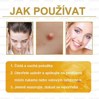 🔥  Dermatologicky a klinicky testováno🐝APKAPK®Bee Venom Krém na obnovení pleti🐝 pomáhá při léčbě kožních problémů, jako jsou: vrásky, jizvy, pigmentové skvrny, strie, akné, psoriáza, ekzém, kožní změny, podráždění, záněty a další kožní problémy.