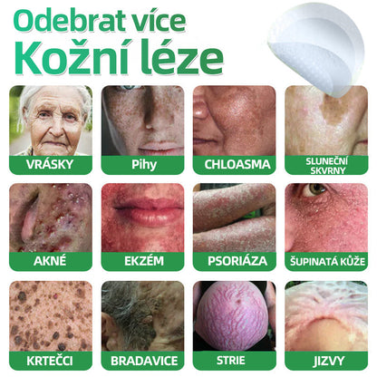 HAJUEI® 📌📌📌 𝟐𝐯𝟏 𝐡𝐲𝐝𝐫𝐨𝐤𝐨𝐥𝐨𝐢𝐝𝐧í 𝐧á𝐩𝐥𝐚𝐬𝐭𝐢 𝐬 𝐦𝐢𝐤𝐫𝐨𝐣𝐞𝐡𝐥𝐢č𝐤𝐚𝐦𝐢 | 𝐒𝐩𝐞𝐜𝐢á𝐥𝐧ě 𝐯𝐲𝐯𝐢𝐧𝐮𝐭é 𝐩𝐫𝐨 𝐨𝐝𝐬𝐭𝐫𝐚𝐧ě𝐧í 𝐯𝐲𝐬𝐭𝐨𝐮𝐩𝐥ý𝐜𝐡 𝐦𝐚𝐭𝐞ř𝐬𝐤ý𝐜𝐡 𝐳𝐧𝐚𝐦é𝐧𝐞𝐤, 𝐚𝐤𝐧é, 𝐩𝐥𝐨𝐜𝐡ý𝐜𝐡 𝐛𝐫𝐚𝐝𝐚𝐯𝐢𝐜 𝐚 𝐤𝐨ž𝐧í𝐜𝐡 𝐯ý𝐫ů𝐬𝐭𝐤ů | 𝐁𝐚𝐥𝐞𝐧í 𝟏𝟒𝟒 𝐤𝐮𝐬ů🌵🌵