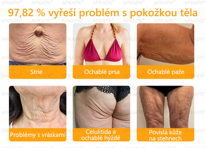 𝖠𝖯𝖪𝖠𝖯𝖪® 🐝 🐝Krém s včelím jedem na obnovu pokožky 🐝 pomáhá při řešení kožních problémů, jako jsou: vrásky, jizvy, pigmentové skvrny, strie, akné, lupénka, ekzém, kožní léze, podráždění, záněty a další kožní potíže.