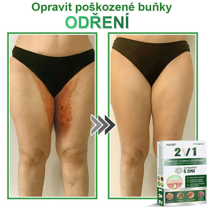 HAJUEI® 📌📌📌 𝟐𝐯𝟏 𝐡𝐲𝐝𝐫𝐨𝐤𝐨𝐥𝐨𝐢𝐝𝐧í 𝐧á𝐩𝐥𝐚𝐬𝐭𝐢 𝐬 𝐦𝐢𝐤𝐫𝐨𝐣𝐞𝐡𝐥𝐢č𝐤𝐚𝐦𝐢 | 𝐒𝐩𝐞𝐜𝐢á𝐥𝐧ě 𝐯𝐲𝐯𝐢𝐧𝐮𝐭é 𝐩𝐫𝐨 𝐨𝐝𝐬𝐭𝐫𝐚𝐧ě𝐧í 𝐯𝐲𝐬𝐭𝐨𝐮𝐩𝐥ý𝐜𝐡 𝐦𝐚𝐭𝐞ř𝐬𝐤ý𝐜𝐡 𝐳𝐧𝐚𝐦é𝐧𝐞𝐤, 𝐚𝐤𝐧é, 𝐩𝐥𝐨𝐜𝐡ý𝐜𝐡 𝐛𝐫𝐚𝐝𝐚𝐯𝐢𝐜 𝐚 𝐤𝐨ž𝐧í𝐜𝐡 𝐯ý𝐫ů𝐬𝐭𝐤ů | 𝐁𝐚𝐥𝐞𝐧í 𝟏𝟒𝟒 𝐤𝐮𝐬ů🌵🌵