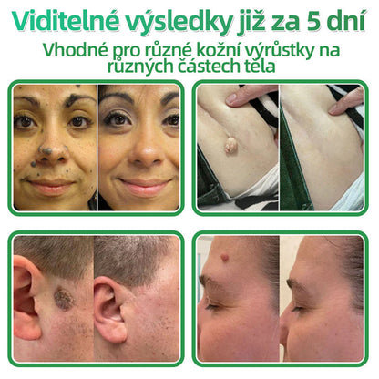 HAJUEI® 📌📌📌 𝟐𝐯𝟏 𝐡𝐲𝐝𝐫𝐨𝐤𝐨𝐥𝐨𝐢𝐝𝐧í 𝐧á𝐩𝐥𝐚𝐬𝐭𝐢 𝐬 𝐦𝐢𝐤𝐫𝐨𝐣𝐞𝐡𝐥𝐢č𝐤𝐚𝐦𝐢 | 𝐒𝐩𝐞𝐜𝐢á𝐥𝐧ě 𝐯𝐲𝐯𝐢𝐧𝐮𝐭é 𝐩𝐫𝐨 𝐨𝐝𝐬𝐭𝐫𝐚𝐧ě𝐧í 𝐯𝐲𝐬𝐭𝐨𝐮𝐩𝐥ý𝐜𝐡 𝐦𝐚𝐭𝐞ř𝐬𝐤ý𝐜𝐡 𝐳𝐧𝐚𝐦é𝐧𝐞𝐤, 𝐚𝐤𝐧é, 𝐩𝐥𝐨𝐜𝐡ý𝐜𝐡 𝐛𝐫𝐚𝐝𝐚𝐯𝐢𝐜 𝐚 𝐤𝐨ž𝐧í𝐜𝐡 𝐯ý𝐫ů𝐬𝐭𝐤ů | 𝐁𝐚𝐥𝐞𝐧í 𝟏𝟒𝟒 𝐤𝐮𝐬ů🌵🌵