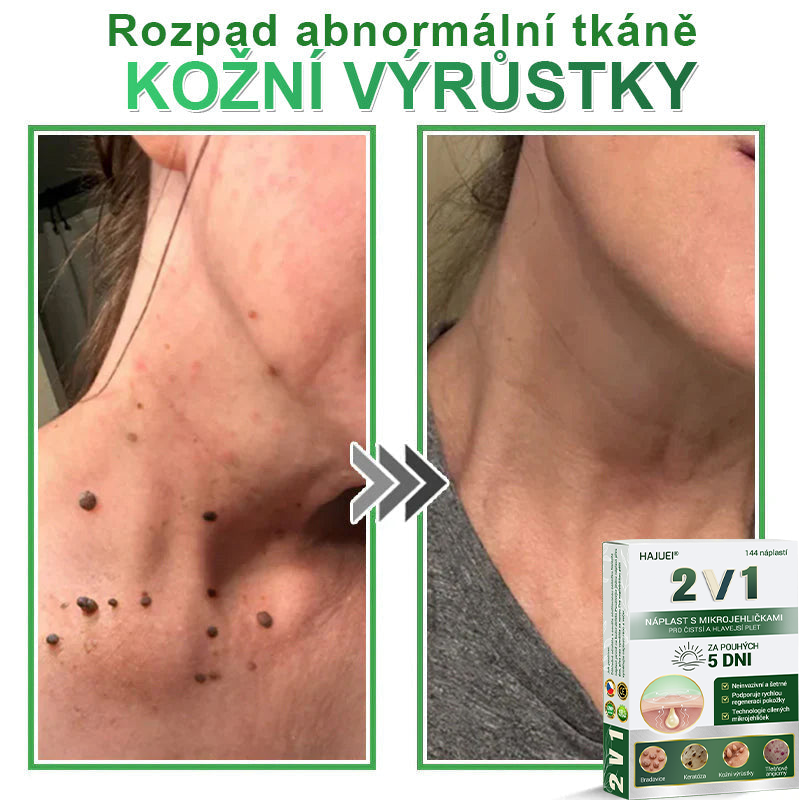 HAJUEI® 📌📌📌 𝟐𝐯𝟏 𝐡𝐲𝐝𝐫𝐨𝐤𝐨𝐥𝐨𝐢𝐝𝐧í 𝐧á𝐩𝐥𝐚𝐬𝐭𝐢 𝐬 𝐦𝐢𝐤𝐫𝐨𝐣𝐞𝐡𝐥𝐢č𝐤𝐚𝐦𝐢 | 𝐒𝐩𝐞𝐜𝐢á𝐥𝐧ě 𝐯𝐲𝐯𝐢𝐧𝐮𝐭é 𝐩𝐫𝐨 𝐨𝐝𝐬𝐭𝐫𝐚𝐧ě𝐧í 𝐯𝐲𝐬𝐭𝐨𝐮𝐩𝐥ý𝐜𝐡 𝐦𝐚𝐭𝐞ř𝐬𝐤ý𝐜𝐡 𝐳𝐧𝐚𝐦é𝐧𝐞𝐤, 𝐚𝐤𝐧é, 𝐩𝐥𝐨𝐜𝐡ý𝐜𝐡 𝐛𝐫𝐚𝐝𝐚𝐯𝐢𝐜 𝐚 𝐤𝐨ž𝐧í𝐜𝐡 𝐯ý𝐫ů𝐬𝐭𝐤ů | 𝐁𝐚𝐥𝐞𝐧í 𝟏𝟒𝟒 𝐤𝐮𝐬ů🌵🌵