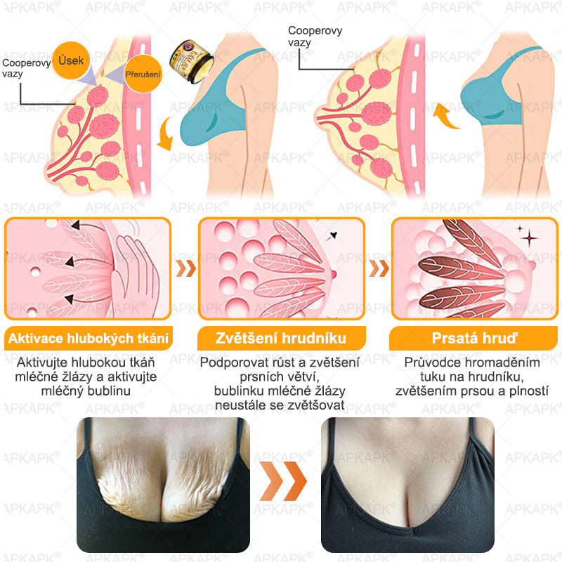 🔥  Dermatologicky a klinicky testováno🐝APKAPK®Bee Venom Krém na obnovení pleti🐝 pomáhá při léčbě kožních problémů, jako jsou: vrásky, jizvy, pigmentové skvrny, strie, akné, psoriáza, ekzém, kožní změny, podráždění, záněty a další kožní problémy.