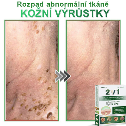 HAJUEI® 📌📌📌 𝟐𝐯𝟏 𝐡𝐲𝐝𝐫𝐨𝐤𝐨𝐥𝐨𝐢𝐝𝐧í 𝐧á𝐩𝐥𝐚𝐬𝐭𝐢 𝐬 𝐦𝐢𝐤𝐫𝐨𝐣𝐞𝐡𝐥𝐢č𝐤𝐚𝐦𝐢 | 𝐒𝐩𝐞𝐜𝐢á𝐥𝐧ě 𝐯𝐲𝐯𝐢𝐧𝐮𝐭é 𝐩𝐫𝐨 𝐨𝐝𝐬𝐭𝐫𝐚𝐧ě𝐧í 𝐯𝐲𝐬𝐭𝐨𝐮𝐩𝐥ý𝐜𝐡 𝐦𝐚𝐭𝐞ř𝐬𝐤ý𝐜𝐡 𝐳𝐧𝐚𝐦é𝐧𝐞𝐤, 𝐚𝐤𝐧é, 𝐩𝐥𝐨𝐜𝐡ý𝐜𝐡 𝐛𝐫𝐚𝐝𝐚𝐯𝐢𝐜 𝐚 𝐤𝐨ž𝐧í𝐜𝐡 𝐯ý𝐫ů𝐬𝐭𝐤ů | 𝐁𝐚𝐥𝐞𝐧í 𝟏𝟒𝟒 𝐤𝐮𝐬ů🌵🌵