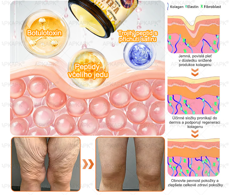 🔥  Dermatologicky a klinicky testováno🐝APKAPK®Bee Venom Krém na obnovení pleti🐝 pomáhá při léčbě kožních problémů, jako jsou: vrásky, jizvy, pigmentové skvrny, strie, akné, psoriáza, ekzém, kožní změny, podráždění, záněty a další kožní problémy.