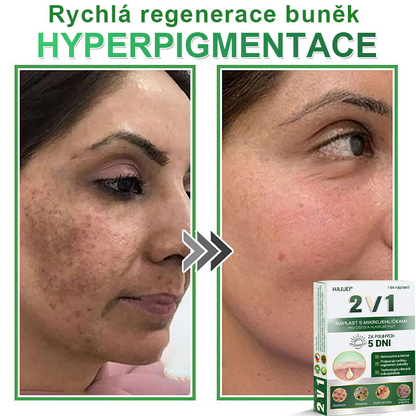 HAJUEI® 📌📌📌 𝟐𝐯𝟏 𝐡𝐲𝐝𝐫𝐨𝐤𝐨𝐥𝐨𝐢𝐝𝐧í 𝐧á𝐩𝐥𝐚𝐬𝐭𝐢 𝐬 𝐦𝐢𝐤𝐫𝐨𝐣𝐞𝐡𝐥𝐢č𝐤𝐚𝐦𝐢 | 𝐒𝐩𝐞𝐜𝐢á𝐥𝐧ě 𝐯𝐲𝐯𝐢𝐧𝐮𝐭é 𝐩𝐫𝐨 𝐨𝐝𝐬𝐭𝐫𝐚𝐧ě𝐧í 𝐯𝐲𝐬𝐭𝐨𝐮𝐩𝐥ý𝐜𝐡 𝐦𝐚𝐭𝐞ř𝐬𝐤ý𝐜𝐡 𝐳𝐧𝐚𝐦é𝐧𝐞𝐤, 𝐚𝐤𝐧é, 𝐩𝐥𝐨𝐜𝐡ý𝐜𝐡 𝐛𝐫𝐚𝐝𝐚𝐯𝐢𝐜 𝐚 𝐤𝐨ž𝐧í𝐜𝐡 𝐯ý𝐫ů𝐬𝐭𝐤ů | 𝐁𝐚𝐥𝐞𝐧í 𝟏𝟒𝟒 𝐤𝐮𝐬ů🌵🌵