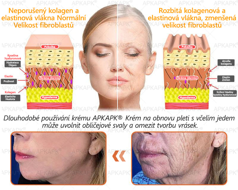𝖠𝖯𝖪𝖠𝖯𝖪® 🐝 🐝Krém s včelím jedem na obnovu pokožky 🐝 pomáhá při řešení kožních problémů, jako jsou: vrásky, jizvy, pigmentové skvrny, strie, akné, lupénka, ekzém, kožní léze, podráždění, záněty a další kožní potíže.