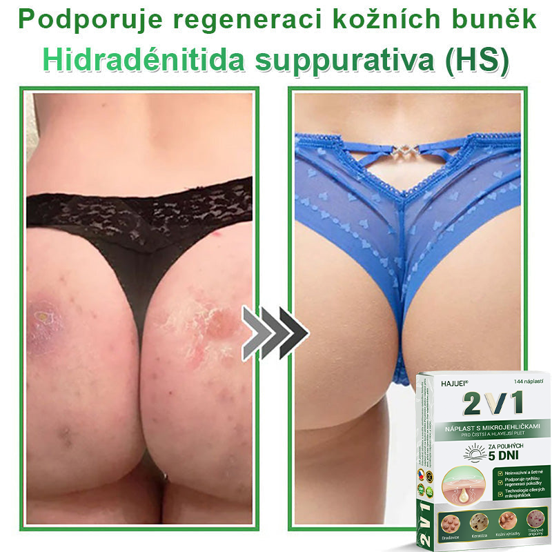HAJUEI® 📌📌📌 𝟐𝐯𝟏 𝐡𝐲𝐝𝐫𝐨𝐤𝐨𝐥𝐨𝐢𝐝𝐧í 𝐧á𝐩𝐥𝐚𝐬𝐭𝐢 𝐬 𝐦𝐢𝐤𝐫𝐨𝐣𝐞𝐡𝐥𝐢č𝐤𝐚𝐦𝐢 | 𝐒𝐩𝐞𝐜𝐢á𝐥𝐧ě 𝐯𝐲𝐯𝐢𝐧𝐮𝐭é 𝐩𝐫𝐨 𝐨𝐝𝐬𝐭𝐫𝐚𝐧ě𝐧í 𝐯𝐲𝐬𝐭𝐨𝐮𝐩𝐥ý𝐜𝐡 𝐦𝐚𝐭𝐞ř𝐬𝐤ý𝐜𝐡 𝐳𝐧𝐚𝐦é𝐧𝐞𝐤, 𝐚𝐤𝐧é, 𝐩𝐥𝐨𝐜𝐡ý𝐜𝐡 𝐛𝐫𝐚𝐝𝐚𝐯𝐢𝐜 𝐚 𝐤𝐨ž𝐧í𝐜𝐡 𝐯ý𝐫ů𝐬𝐭𝐤ů | 𝐁𝐚𝐥𝐞𝐧í 𝟏𝟒𝟒 𝐤𝐮𝐬ů🌵🌵