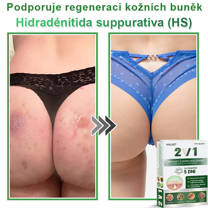 HAJUEI® 📌📌📌 𝟐𝐯𝟏 𝐡𝐲𝐝𝐫𝐨𝐤𝐨𝐥𝐨𝐢𝐝𝐧í 𝐧á𝐩𝐥𝐚𝐬𝐭𝐢 𝐬 𝐦𝐢𝐤𝐫𝐨𝐣𝐞𝐡𝐥𝐢č𝐤𝐚𝐦𝐢 | 𝐒𝐩𝐞𝐜𝐢á𝐥𝐧ě 𝐯𝐲𝐯𝐢𝐧𝐮𝐭é 𝐩𝐫𝐨 𝐨𝐝𝐬𝐭𝐫𝐚𝐧ě𝐧í 𝐯𝐲𝐬𝐭𝐨𝐮𝐩𝐥ý𝐜𝐡 𝐦𝐚𝐭𝐞ř𝐬𝐤ý𝐜𝐡 𝐳𝐧𝐚𝐦é𝐧𝐞𝐤, 𝐚𝐤𝐧é, 𝐩𝐥𝐨𝐜𝐡ý𝐜𝐡 𝐛𝐫𝐚𝐝𝐚𝐯𝐢𝐜 𝐚 𝐤𝐨ž𝐧í𝐜𝐡 𝐯ý𝐫ů𝐬𝐭𝐤ů | 𝐁𝐚𝐥𝐞𝐧í 𝟏𝟒𝟒 𝐤𝐮𝐬ů🌵🌵
