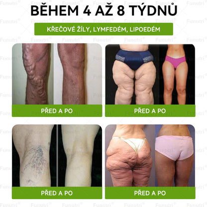 Oficiální obchod 🧪  ✅Funutri® 10 v 1 metabolická tvarující náplast s nano mikrojehličkami (Pouze jednou denně, viditelné změny již za 7 dní)  Určeno pro osoby s obezitou, diabetem, spánkovou apnoe
