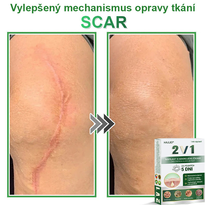 HAJUEI® 📌📌📌 𝟐𝐯𝟏 𝐡𝐲𝐝𝐫𝐨𝐤𝐨𝐥𝐨𝐢𝐝𝐧í 𝐧á𝐩𝐥𝐚𝐬𝐭𝐢 𝐬 𝐦𝐢𝐤𝐫𝐨𝐣𝐞𝐡𝐥𝐢č𝐤𝐚𝐦𝐢 | 𝐒𝐩𝐞𝐜𝐢á𝐥𝐧ě 𝐯𝐲𝐯𝐢𝐧𝐮𝐭é 𝐩𝐫𝐨 𝐨𝐝𝐬𝐭𝐫𝐚𝐧ě𝐧í 𝐯𝐲𝐬𝐭𝐨𝐮𝐩𝐥ý𝐜𝐡 𝐦𝐚𝐭𝐞ř𝐬𝐤ý𝐜𝐡 𝐳𝐧𝐚𝐦é𝐧𝐞𝐤, 𝐚𝐤𝐧é, 𝐩𝐥𝐨𝐜𝐡ý𝐜𝐡 𝐛𝐫𝐚𝐝𝐚𝐯𝐢𝐜 𝐚 𝐤𝐨ž𝐧í𝐜𝐡 𝐯ý𝐫ů𝐬𝐭𝐤ů | 𝐁𝐚𝐥𝐞𝐧í 𝟏𝟒𝟒 𝐤𝐮𝐬ů🌵🌵