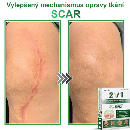 HAJUEI® 📌📌📌 𝟐𝐯𝟏 𝐡𝐲𝐝𝐫𝐨𝐤𝐨𝐥𝐨𝐢𝐝𝐧í 𝐧á𝐩𝐥𝐚𝐬𝐭𝐢 𝐬 𝐦𝐢𝐤𝐫𝐨𝐣𝐞𝐡𝐥𝐢č𝐤𝐚𝐦𝐢 | 𝐒𝐩𝐞𝐜𝐢á𝐥𝐧ě 𝐯𝐲𝐯𝐢𝐧𝐮𝐭é 𝐩𝐫𝐨 𝐨𝐝𝐬𝐭𝐫𝐚𝐧ě𝐧í 𝐯𝐲𝐬𝐭𝐨𝐮𝐩𝐥ý𝐜𝐡 𝐦𝐚𝐭𝐞ř𝐬𝐤ý𝐜𝐡 𝐳𝐧𝐚𝐦é𝐧𝐞𝐤, 𝐚𝐤𝐧é, 𝐩𝐥𝐨𝐜𝐡ý𝐜𝐡 𝐛𝐫𝐚𝐝𝐚𝐯𝐢𝐜 𝐚 𝐤𝐨ž𝐧í𝐜𝐡 𝐯ý𝐫ů𝐬𝐭𝐤ů | 𝐁𝐚𝐥𝐞𝐧í 𝟏𝟒𝟒 𝐤𝐮𝐬ů🌵🌵