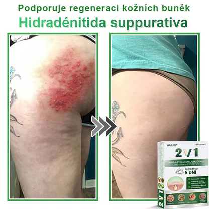 HAJUEI® 📌📌📌 𝟐𝐯𝟏 𝐡𝐲𝐝𝐫𝐨𝐤𝐨𝐥𝐨𝐢𝐝𝐧í 𝐧á𝐩𝐥𝐚𝐬𝐭𝐢 𝐬 𝐦𝐢𝐤𝐫𝐨𝐣𝐞𝐡𝐥𝐢č𝐤𝐚𝐦𝐢 | 𝐒𝐩𝐞𝐜𝐢á𝐥𝐧ě 𝐯𝐲𝐯𝐢𝐧𝐮𝐭é 𝐩𝐫𝐨 𝐨𝐝𝐬𝐭𝐫𝐚𝐧ě𝐧í 𝐯𝐲𝐬𝐭𝐨𝐮𝐩𝐥ý𝐜𝐡 𝐦𝐚𝐭𝐞ř𝐬𝐤ý𝐜𝐡 𝐳𝐧𝐚𝐦é𝐧𝐞𝐤, 𝐚𝐤𝐧é, 𝐩𝐥𝐨𝐜𝐡ý𝐜𝐡 𝐛𝐫𝐚𝐝𝐚𝐯𝐢𝐜 𝐚 𝐤𝐨ž𝐧í𝐜𝐡 𝐯ý𝐫ů𝐬𝐭𝐤ů | 𝐁𝐚𝐥𝐞𝐧í 𝟏𝟒𝟒 𝐤𝐮𝐬ů🌵🌵