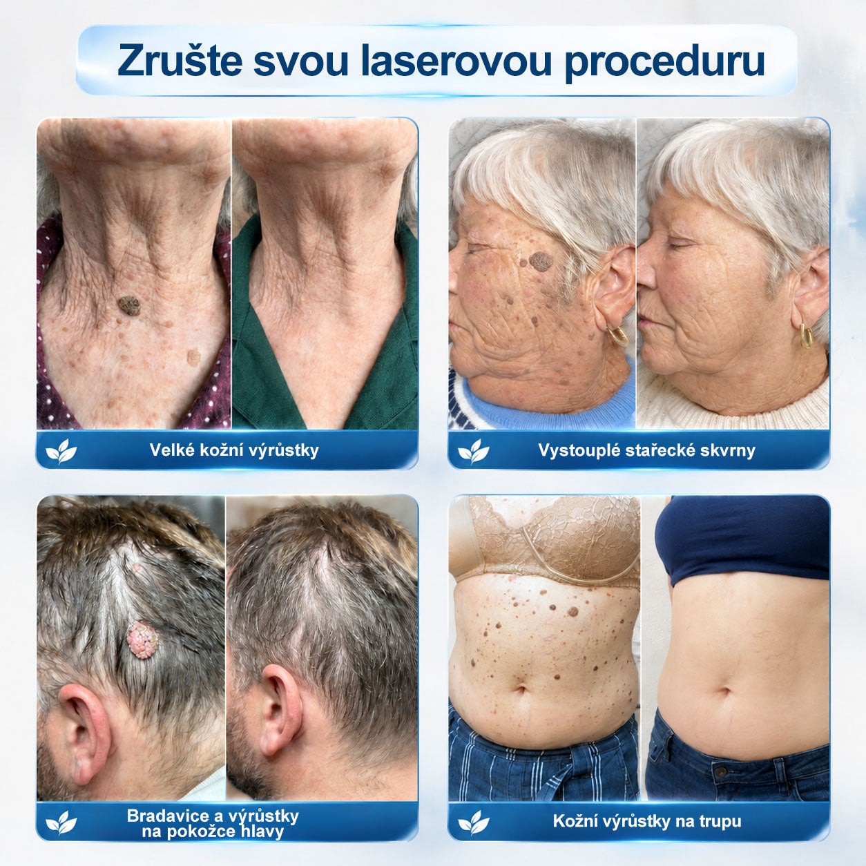 🐬🧪Oficiální značkový obchod | Hiskin® 7denní odstraňovač skvrn a pigmentových skvrn (Bezbolestný rollerball bez jizev)