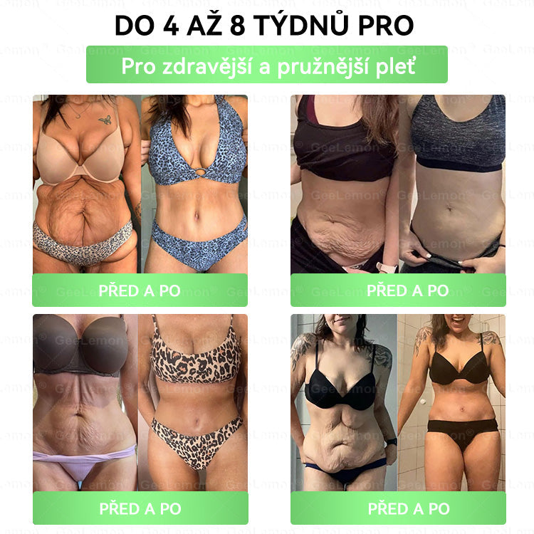 🎁🎁 GeeLemon® – 🎁 Na skladě zbývá už jen 5 balení! Nyní se slevou 50 %! Dostaňte se do formy a podpořte své zdraví ještě dnes. Pokud tuto příležitost teď propásnete, další možnost bude až příští rok!