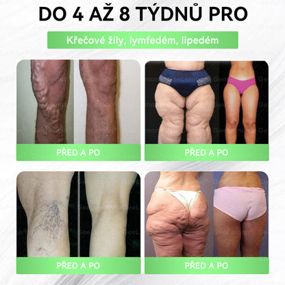 🎁🎁 GeeLemon® – 🎁 Na skladě zbývá už jen 5 balení! Nyní se slevou 50 %! Dostaňte se do formy a podpořte své zdraví ještě dnes. Pokud tuto příležitost teď propásnete, další možnost bude až příští rok!