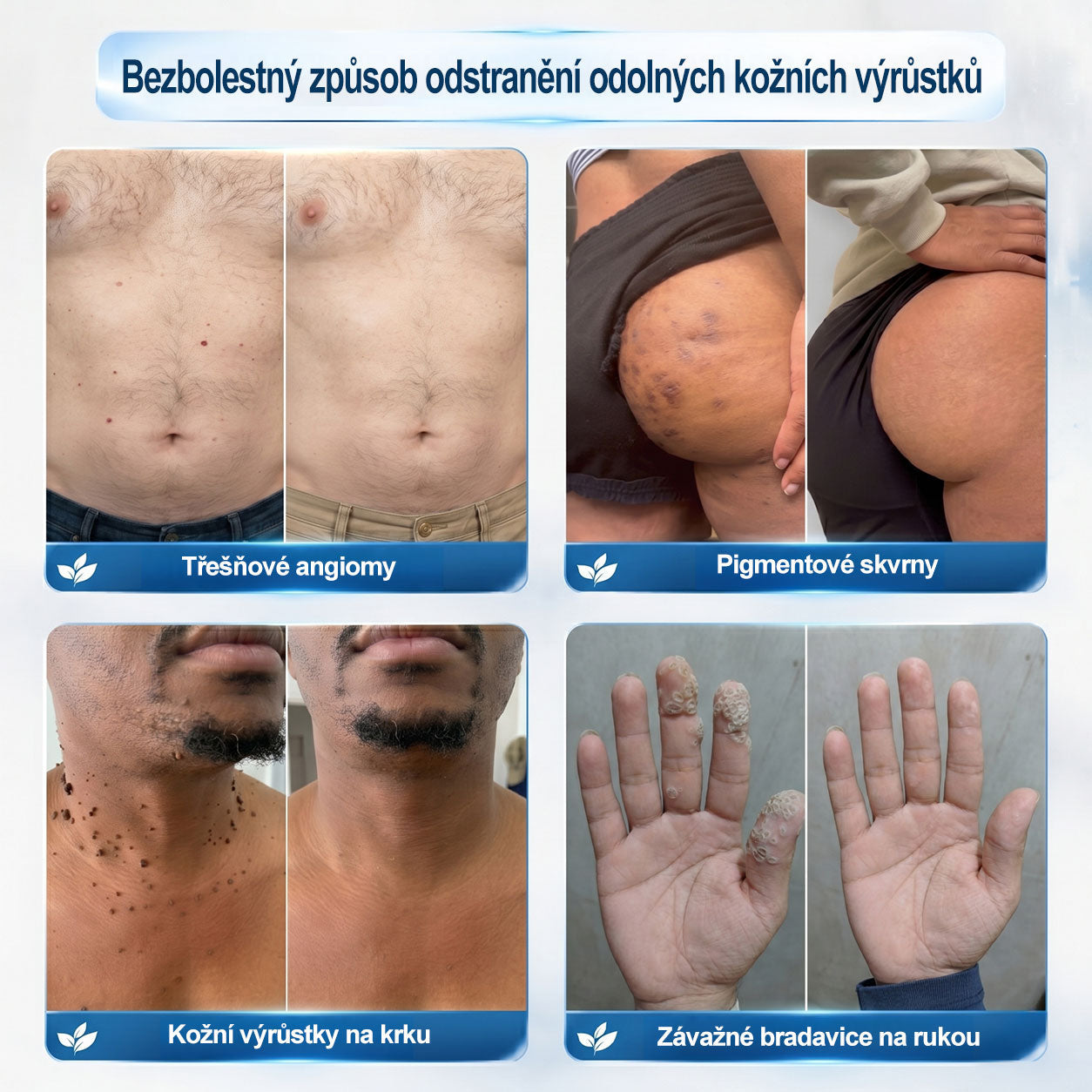 🐬🧪Oficiální značkový obchod | Hiskin® 7denní odstraňovač skvrn a pigmentových skvrn (Bezbolestný rollerball bez jizev)