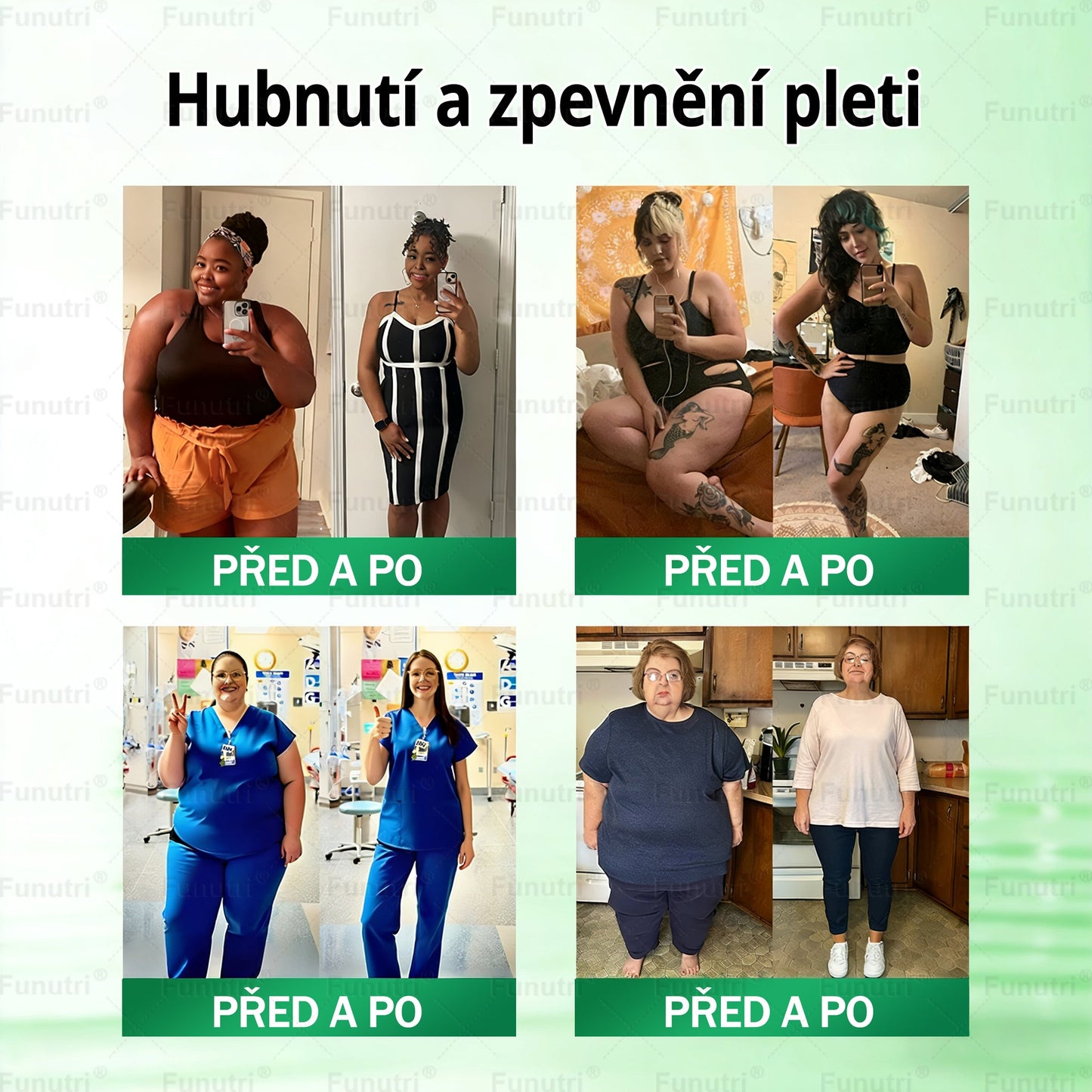 Oficiální obchod 🧪  ✅Funutri® 10 v 1 metabolická tvarující náplast s nano mikrojehličkami (Pouze jednou denně, viditelné změny již za 7 dní)  Určeno pro osoby s obezitou, diabetem, spánkovou apnoe