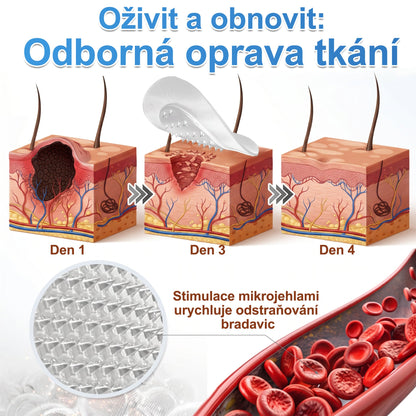 ✨ PURESHADE® 2v1 mikrojehličková + hydrokoloidní náplast🍀 | Pomáhá odstraňovat vystouplá znaménka, akné, ploché bradavice a kožní výrůstky | Pomáhá zjemnit vrásky, jizvy a nedokonalosti pleti | Diskrétní neviditelná náplast pro obličej i tělo