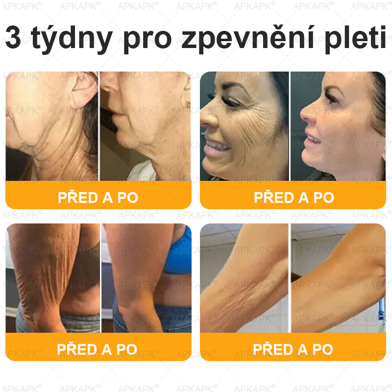 🔥  Dermatologicky a klinicky testováno🐝APKAPK®Bee Venom Krém na obnovení pleti🐝 pomáhá při léčbě kožních problémů, jako jsou: vrásky, jizvy, pigmentové skvrny, strie, akné, psoriáza, ekzém, kožní změny, podráždění, záněty a další kožní problémy.