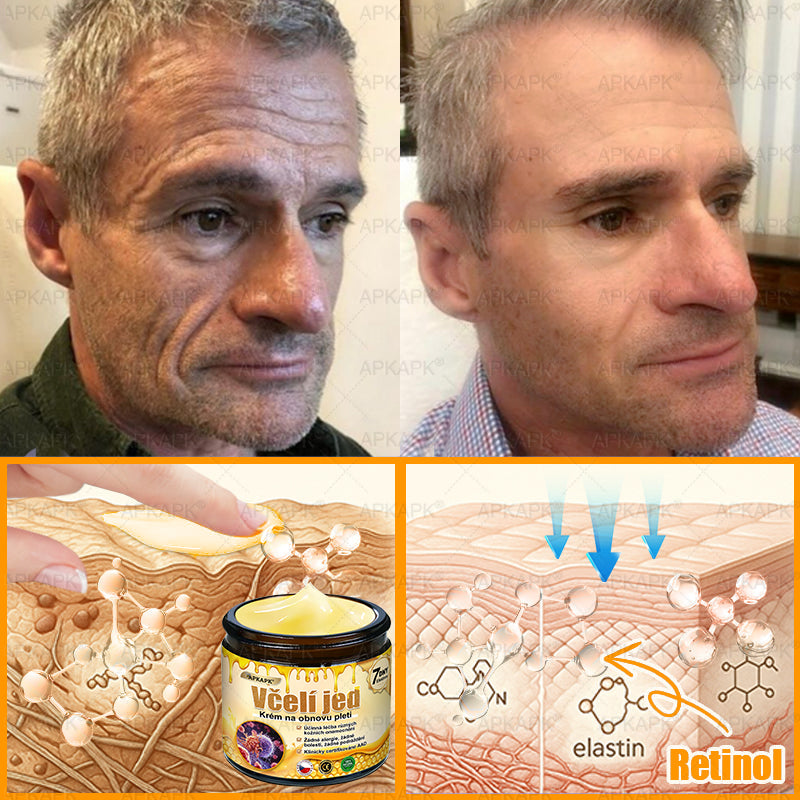 🔥  Dermatologicky a klinicky testováno🐝APKAPK®Bee Venom Krém na obnovení pleti🐝 pomáhá při léčbě kožních problémů, jako jsou: vrásky, jizvy, pigmentové skvrny, strie, akné, psoriáza, ekzém, kožní změny, podráždění, záněty a další kožní problémy.