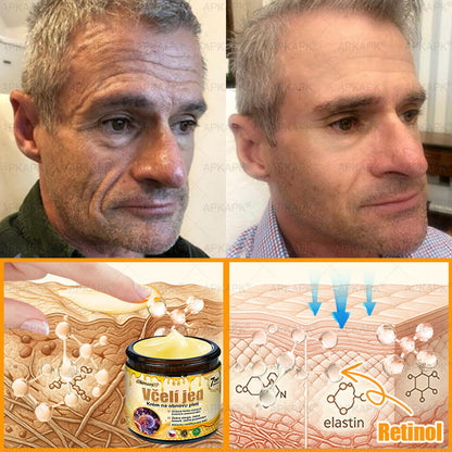 🔥  Dermatologicky a klinicky testováno🐝APKAPK®Bee Venom Krém na obnovení pleti🐝 pomáhá při léčbě kožních problémů, jako jsou: vrásky, jizvy, pigmentové skvrny, strie, akné, psoriáza, ekzém, kožní změny, podráždění, záněty a další kožní problémy.