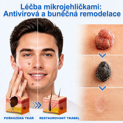 ✨ PURESHADE® 2v1 mikrojehličková + hydrokoloidní náplast🍀 | Pomáhá odstraňovat vystouplá znaménka, akné, ploché bradavice a kožní výrůstky | Pomáhá zjemnit vrásky, jizvy a nedokonalosti pleti | Diskrétní neviditelná náplast pro obličej i tělo