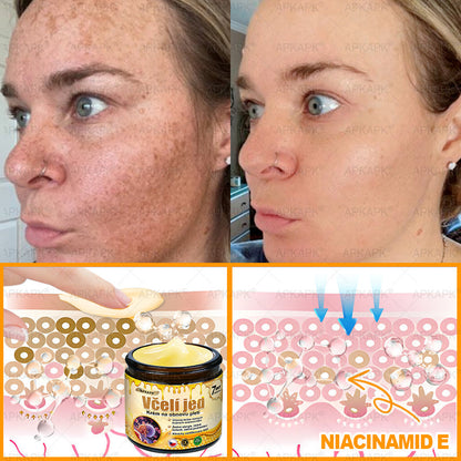 🔥  Dermatologicky a klinicky testováno🐝APKAPK®Bee Venom Krém na obnovení pleti🐝 pomáhá při léčbě kožních problémů, jako jsou: vrásky, jizvy, pigmentové skvrny, strie, akné, psoriáza, ekzém, kožní změny, podráždění, záněty a další kožní problémy.
