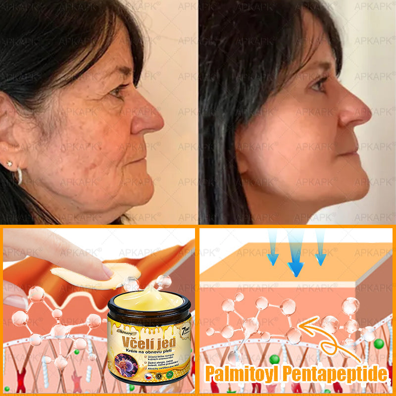 🔥  Dermatologicky a klinicky testováno🐝APKAPK®Bee Venom Krém na obnovení pleti🐝 pomáhá při léčbě kožních problémů, jako jsou: vrásky, jizvy, pigmentové skvrny, strie, akné, psoriáza, ekzém, kožní změny, podráždění, záněty a další kožní problémy.