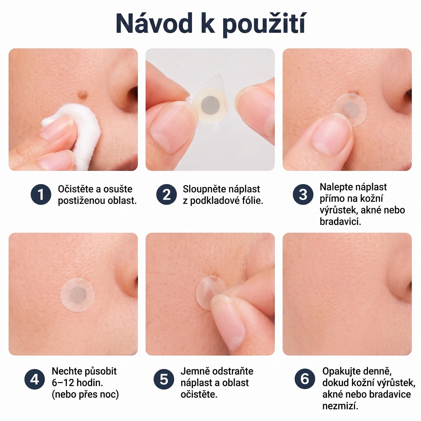 ✨ PURESHADE® 2v1 mikrojehličková + hydrokoloidní náplast🍀 | Pomáhá odstraňovat vystouplá znaménka, akné, ploché bradavice a kožní výrůstky | Pomáhá zjemnit vrásky, jizvy a nedokonalosti pleti | Diskrétní neviditelná náplast pro obličej i tělo