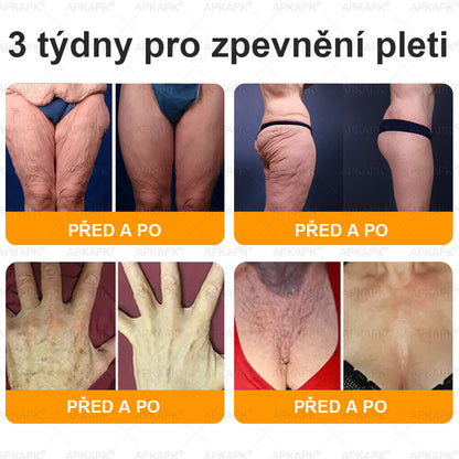 🔥  Dermatologicky a klinicky testováno🐝APKAPK®Bee Venom Krém na obnovení pleti🐝 pomáhá při léčbě kožních problémů, jako jsou: vrásky, jizvy, pigmentové skvrny, strie, akné, psoriáza, ekzém, kožní změny, podráždění, záněty a další kožní problémy.