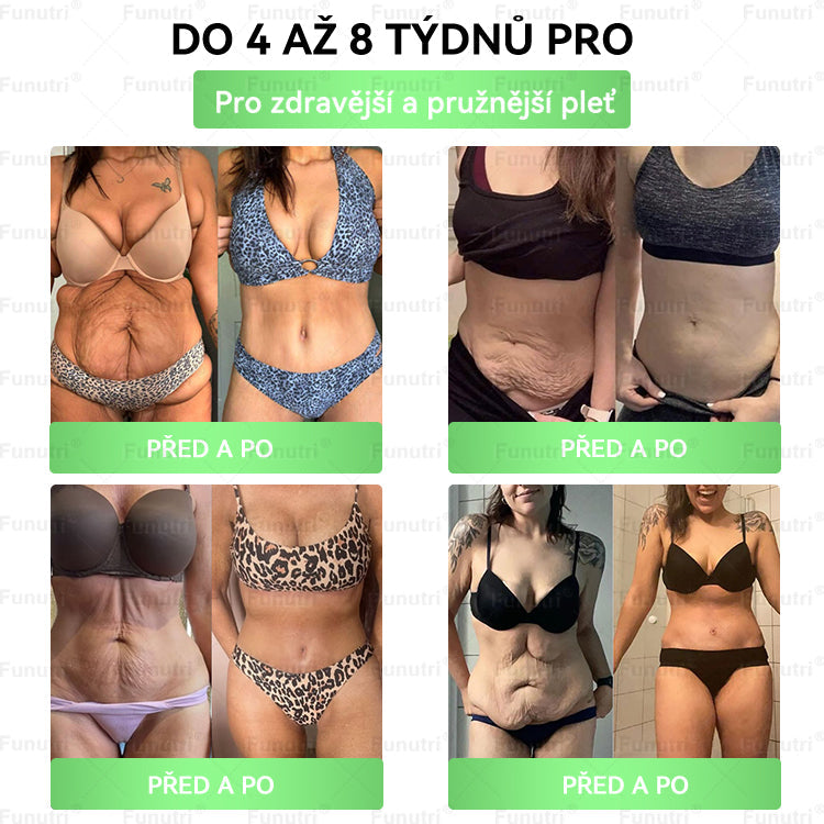 Oficiální obchod 🧪  ✅Funutri® 10 v 1 metabolická tvarující náplast s nano mikrojehličkami (Pouze jednou denně, viditelné změny již za 7 dní)  Určeno pro osoby s obezitou, diabetem, spánkovou apnoe